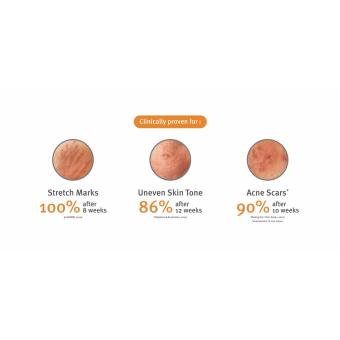 Bio Oil Original 100% Purecellin Oil Penghilang Bekas JerawatStretch Mark Bekas Luka Untuk Ibu Hamil Juni 2019 - 4 Bio Oil Original 100% Purecellin Oil Penghilang Bekas JerawatStretch Mark Bekas Luka untuk Ibu Hamil - 4