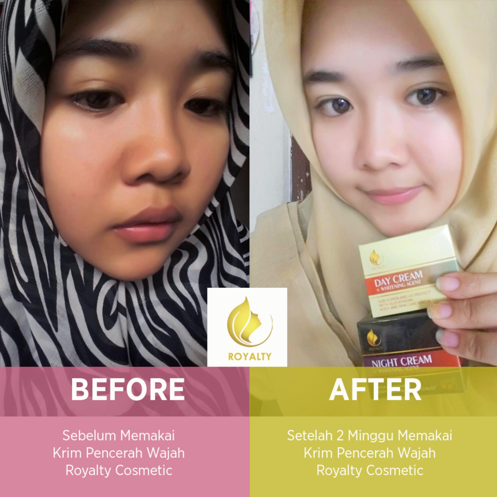 Krim Malam Pemutih Wajah Anti Aging Bekas Jerawat Dan Flek Hitam Krim Malam Pemutih Wajah Anti Aging Menghilangkan Bekas Jerawatdan Flek Hitam
