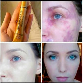 Oboshop Jual Warna Kulit Kuning Langsat Dermacol Makeup Cover Foundation 211 Aman Untuk Kulit Sensitif Online Murah